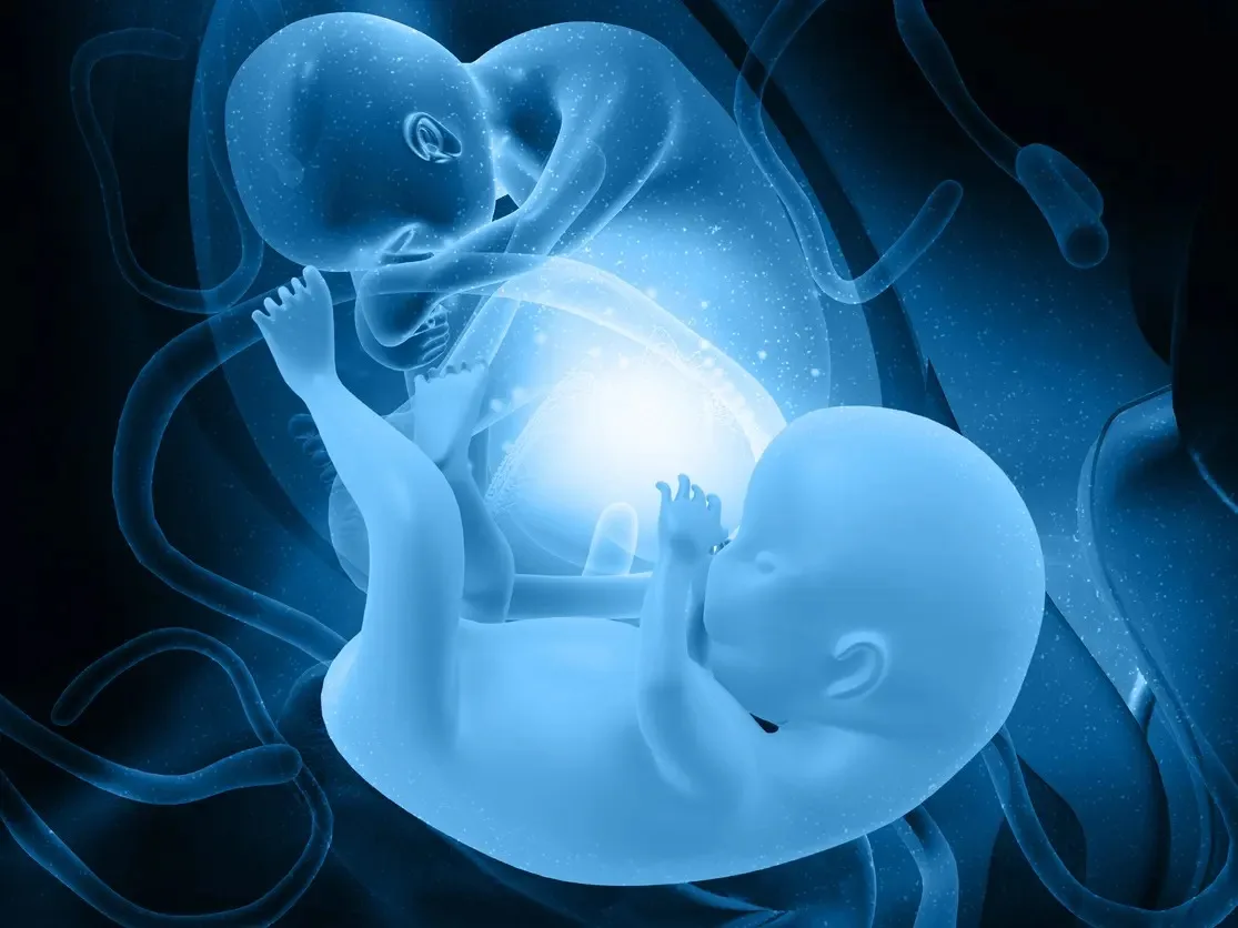 حالة نادرة لحمل متعدد