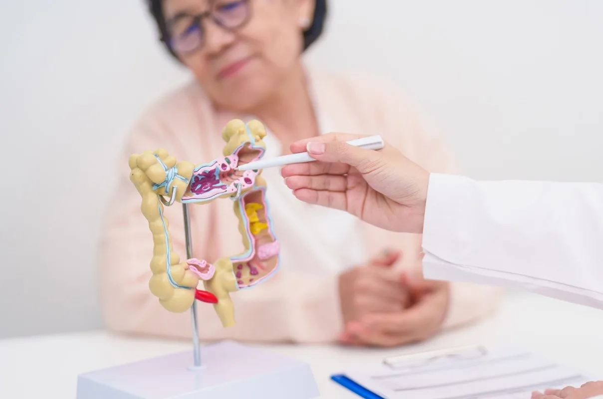 اكتشاف كوري يفتح بابًا جديدًا لإبطاء سرطان القولون